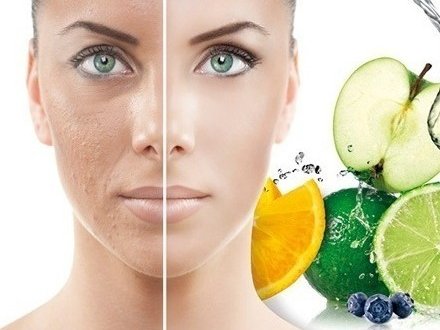 SKIN TREATMENT GEVOELIGE HUID